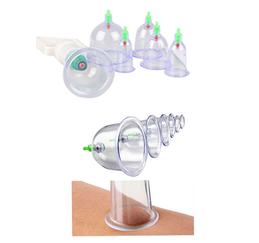 7pcs Chinese Cupping Set